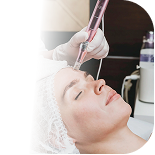 Conceptos básicos del dermapen