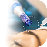 Dermapen técnicas de infiltración y principios activos